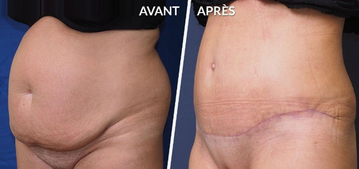 chirurgie réparatrice proposée par le Dr Laurent Agay à hôpital de Narbonne