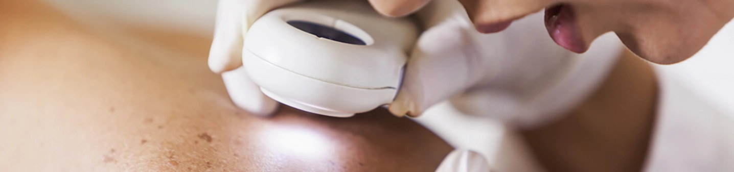 consultation_dermatologie_hopital_narbonne